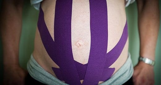 blog picture of close up of pregnant women with kinesiotape strips on belly