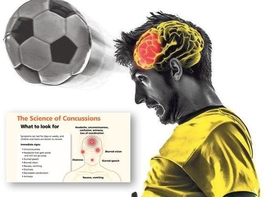 ‘Heading’ Soccer Ball Not Smart for The Brain