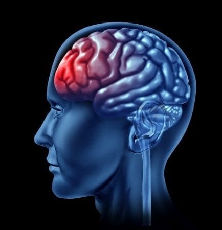 blog illustration of profile of human brain and the frontal lobe in red