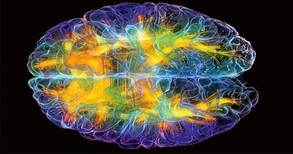 blog picture of multicolored brain