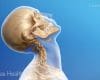 blog de imágenes del esqueleto latigazo cervical