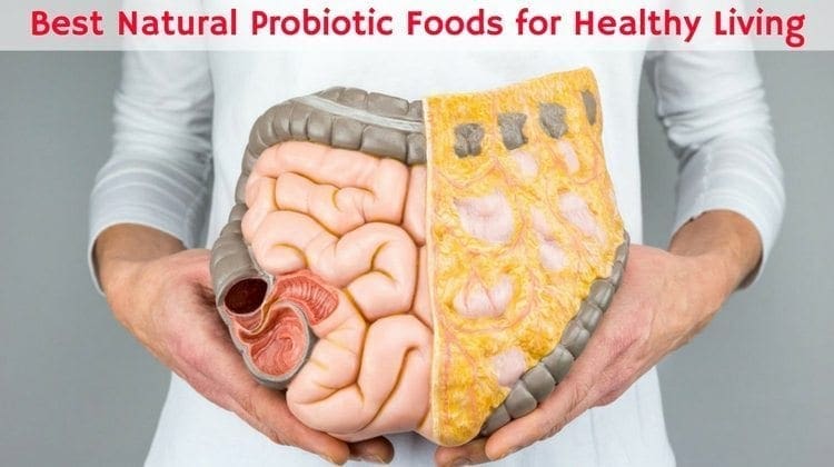 חיים בריא 10 מזון טבעי הטוב ביותר Probiotic