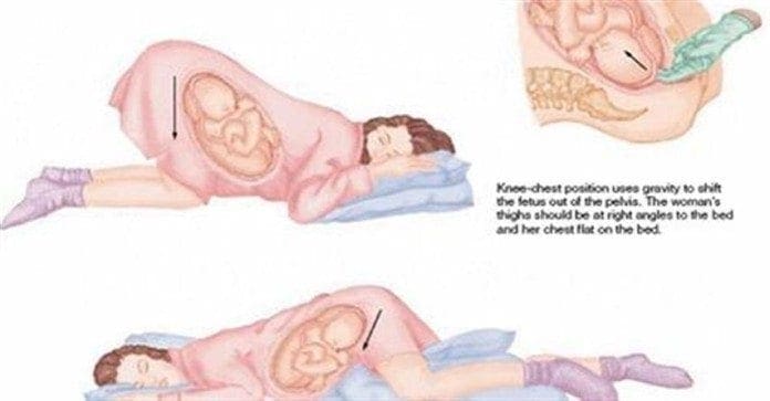 Sleeping Position During Pregnancy With Pictures