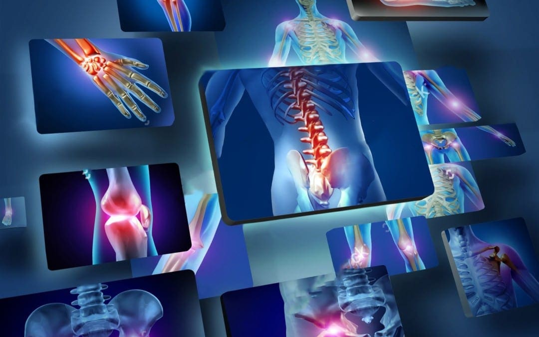 blog picture of joint inflammation