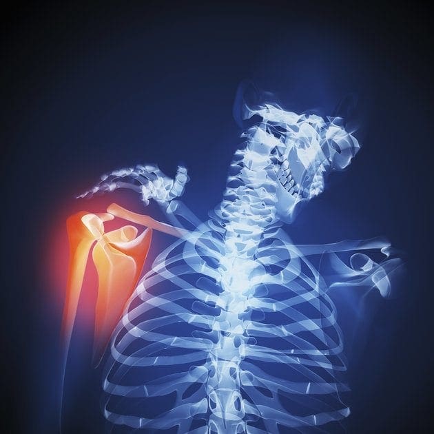shoulder pain rehab el paso tx.