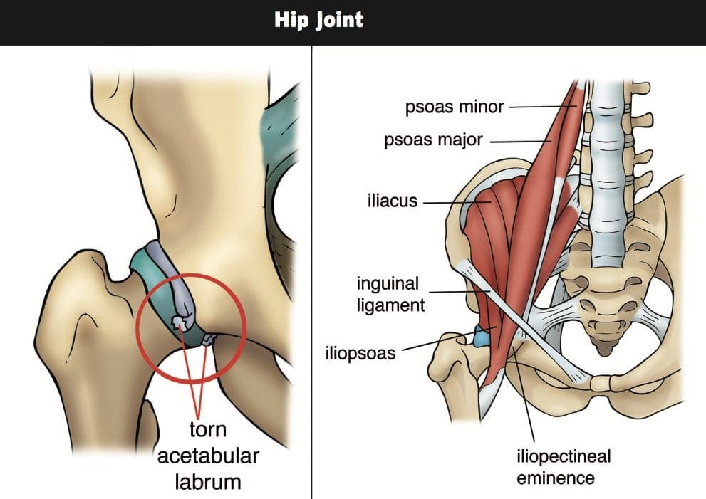 trattamento chiropratico al dolore dell'anca el paso tx.