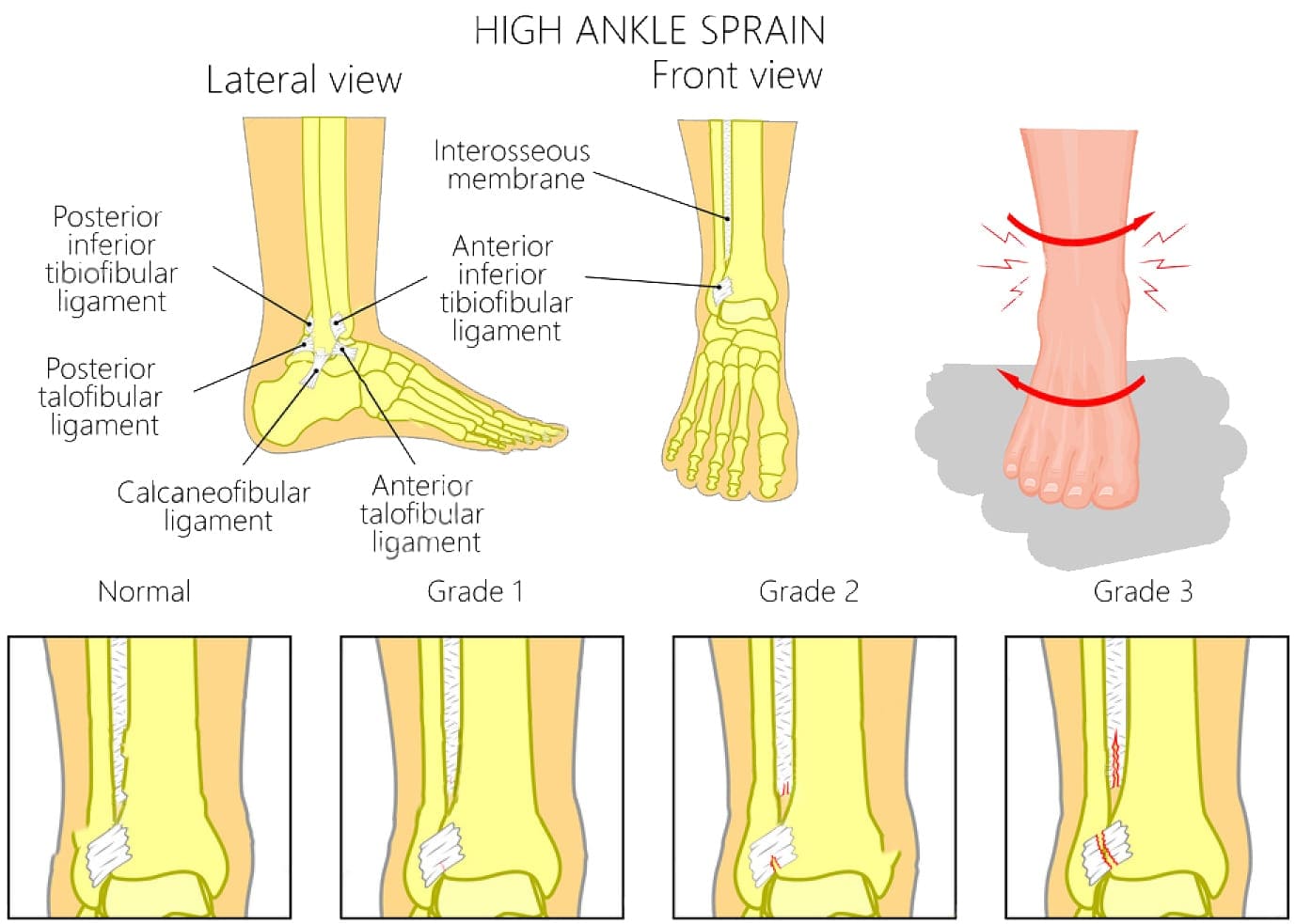 sprain and strain treatment - injury medical and chiropractic clinic el paso, tx.