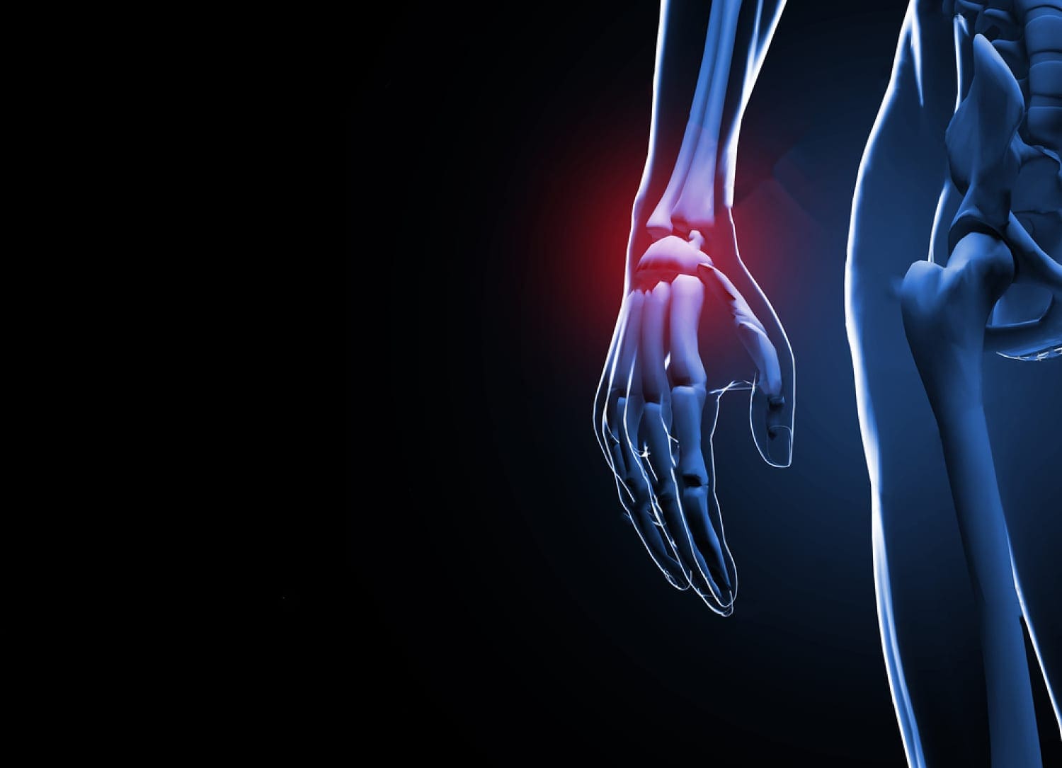 Scaphoid Fracture Recovery: What You Need to Know