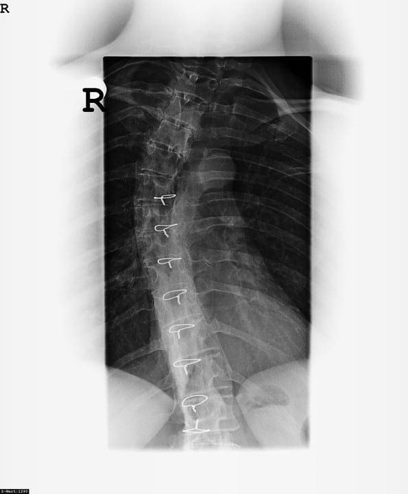 רנטגן עמוד השדרה אל paso tx