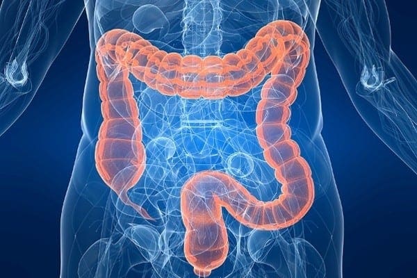 Gastrointestinal diseases explained using a colon diagram