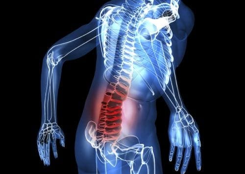 vertebrogenic