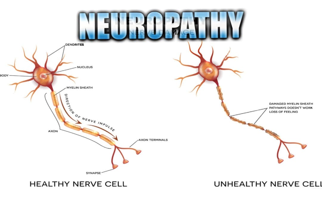 Neuropathy Presentation | El Paso, TX. | Part I