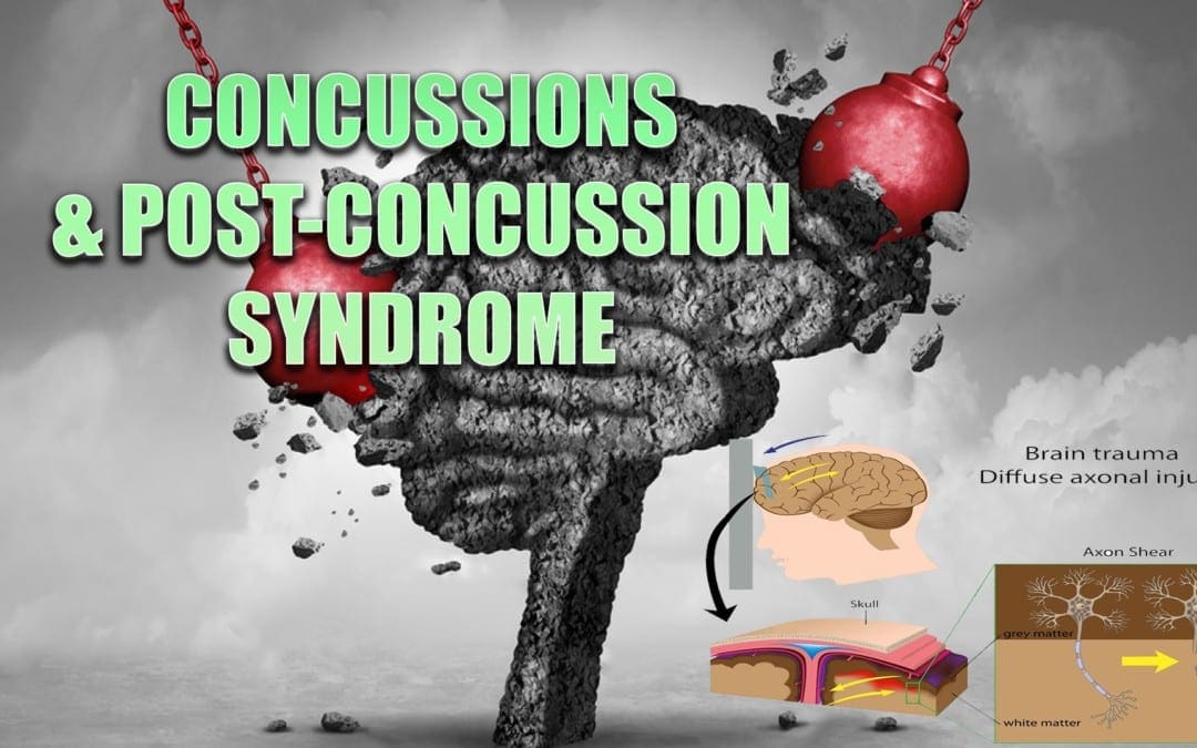 Concussions & Post-Concussion Syndrome