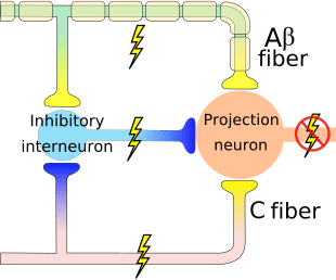 Diagram Teori Gerbang Kontrol 1 | El Paso, TX Chiropractor