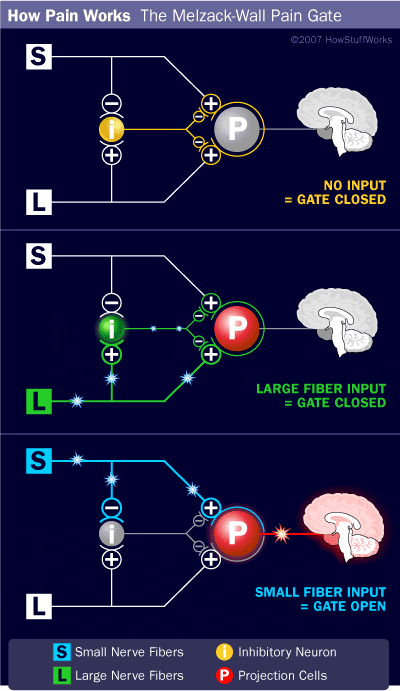 Gate Control Theory Diagram 2 | El Paso, TX Chiropractor