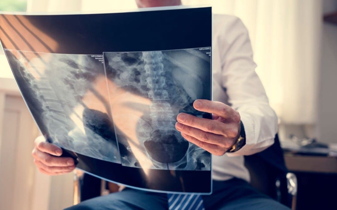Approccio diagnostico per immagini di infezione spinale El Paso, TX.