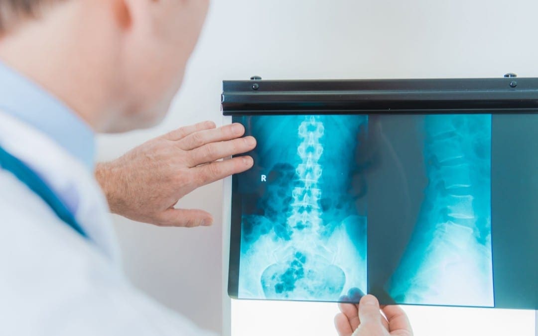 Spinal Arthritis Diagnostic Imaging Approach Part I