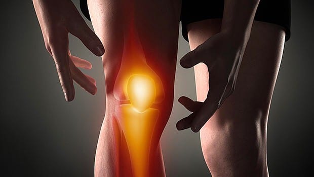 Evaluation of Patients Presenting with Knee Pain: Part II. Differential Diagnosis