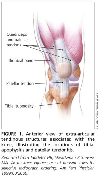 Figura 1 Vista anteriore delle strutture del ginocchio