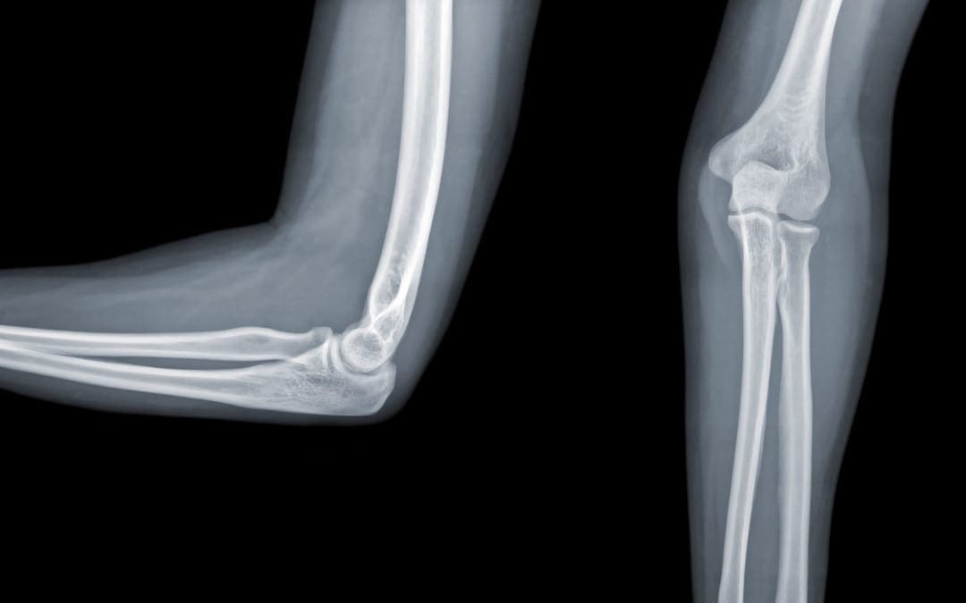 i-elbow imaging el paso tx.
