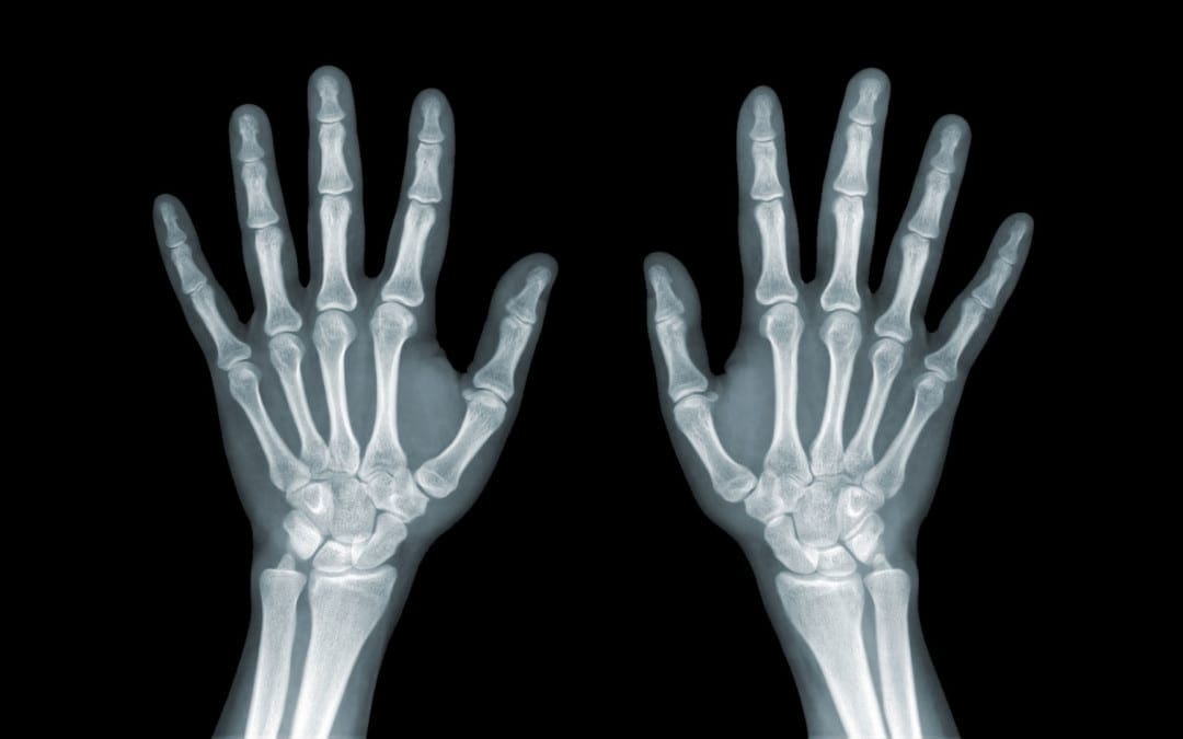 diagnostica del polso a mano imaging el paso tx.