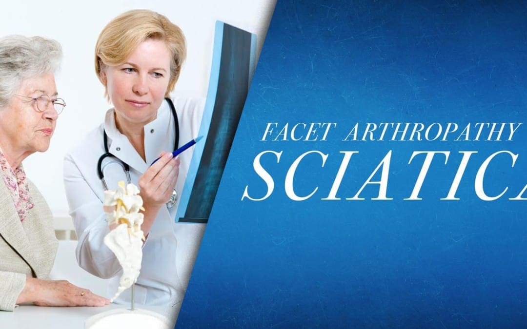 Facet Arthropathy vs Sciatica