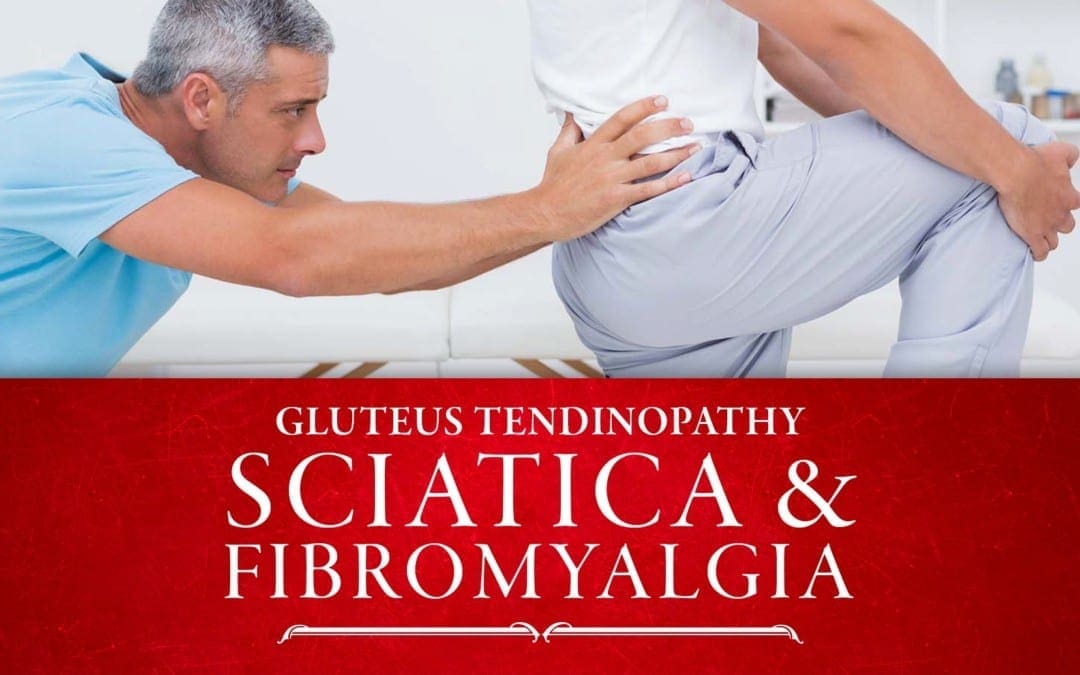 Gluteus Tendinopathy, Sciatica and Fibromyalgia | El Paso, TX Chiropractor