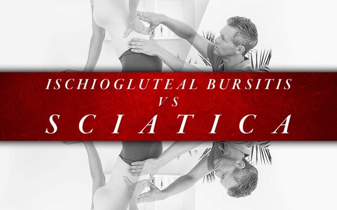 Ischiogluteal Bursitis vs Sciatica | എൽ പാസോ, TX കൈറോപ്രാക്റ്റർ