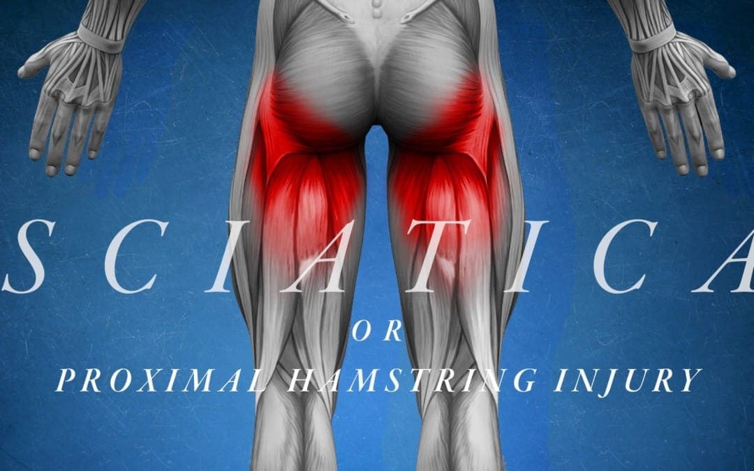 Sciatica or Proximal Hamstring Injury