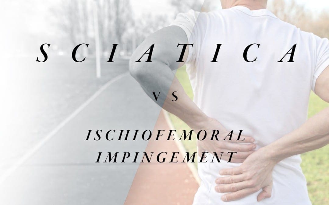 Sciatica vs Ischiofemoral Impingement | El Paso, TX Chiropractor