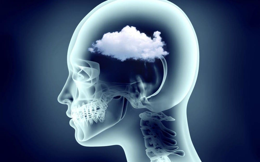 Functional Neurology: Understanding Brain Fog and Head Pain | El Paso, TX Chiropractor