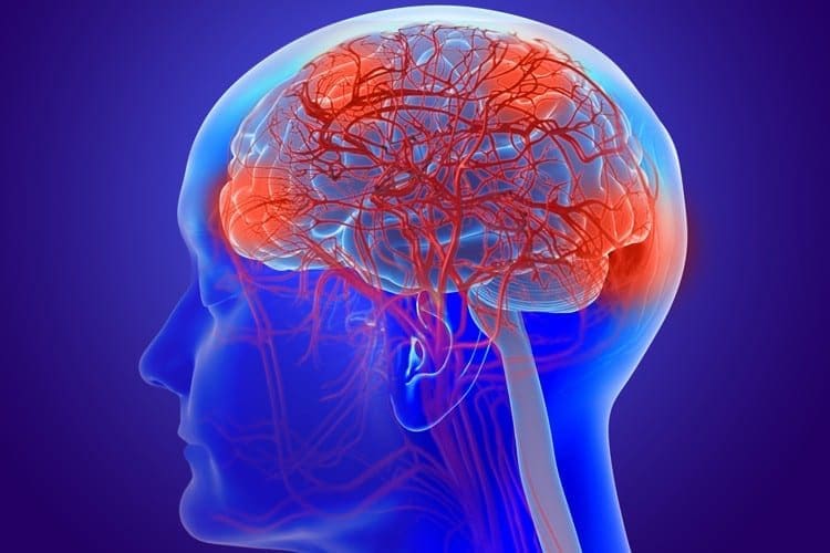 Neurologia funzionale: cos'è un cervello che perde? | Chiropratico El Paso, TX
