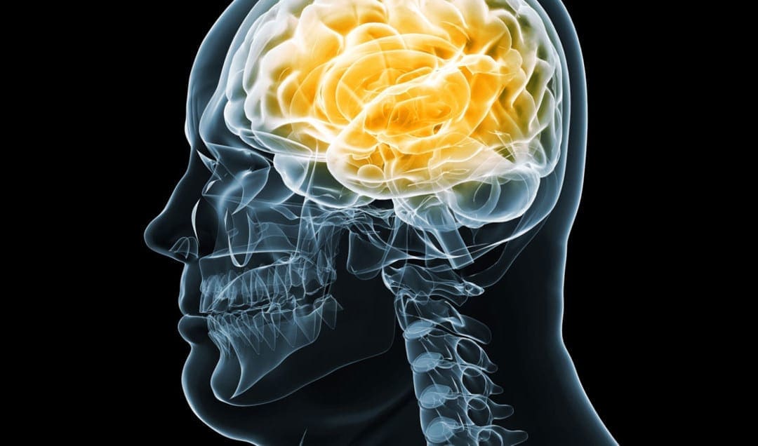 נוירולוגיה תפקודית: בריאות מוח והשמנת יתר