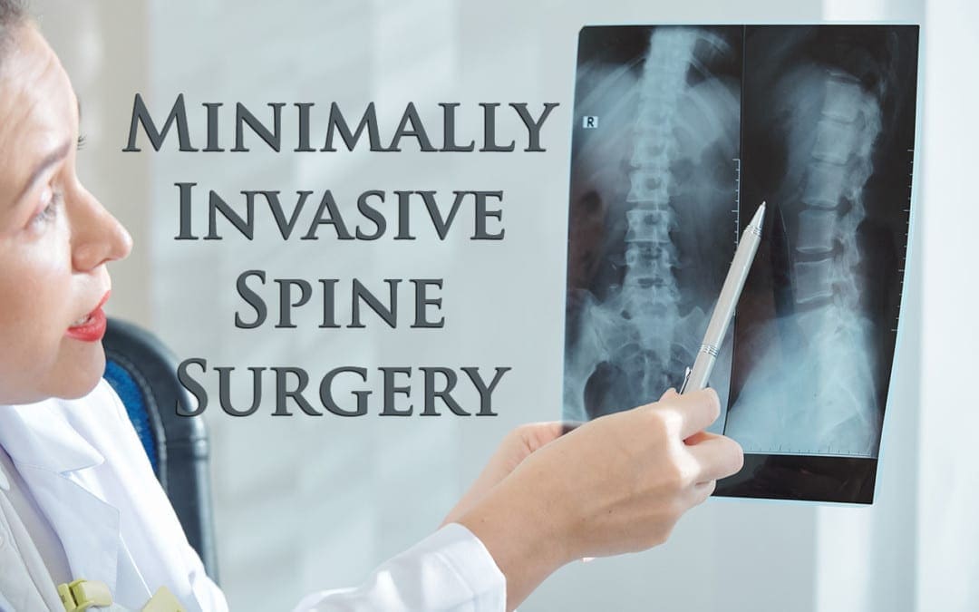 11860 Vista Del Sol, Ste. Exactly What Is Minimally Invasive Spine Surgery
