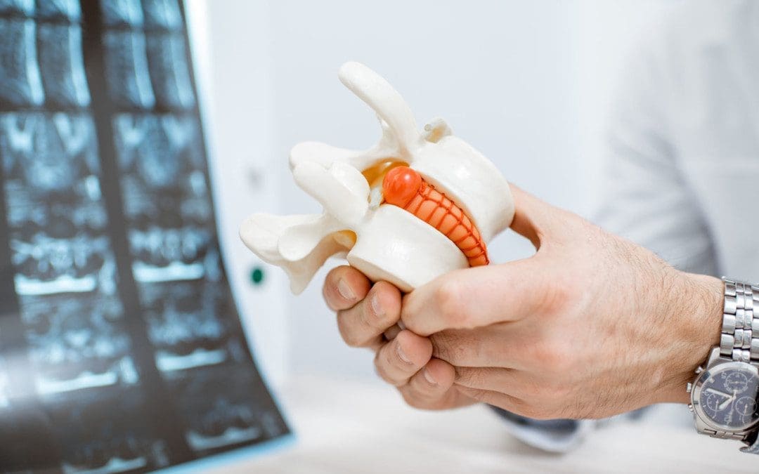 The Size of A Herniated Disc