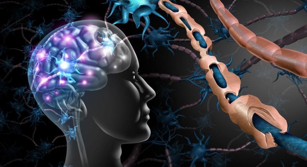 The Impact Of Multiple Sclerosis On The Body