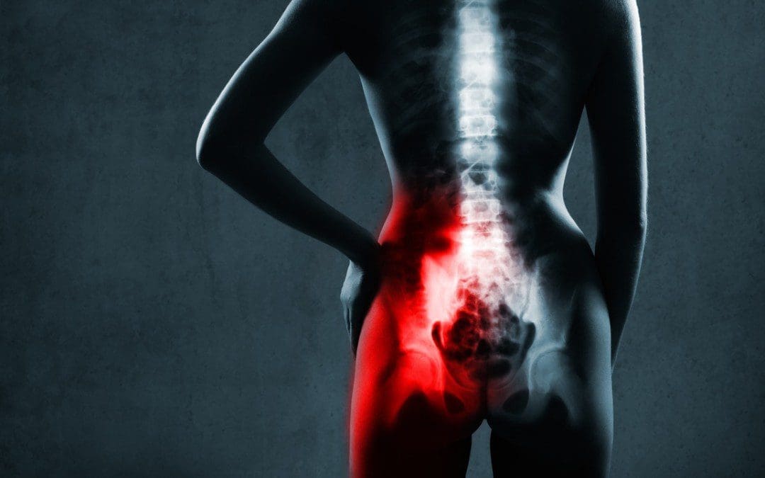 Sacroiliac Dysfunction Causes More Than Back Issues