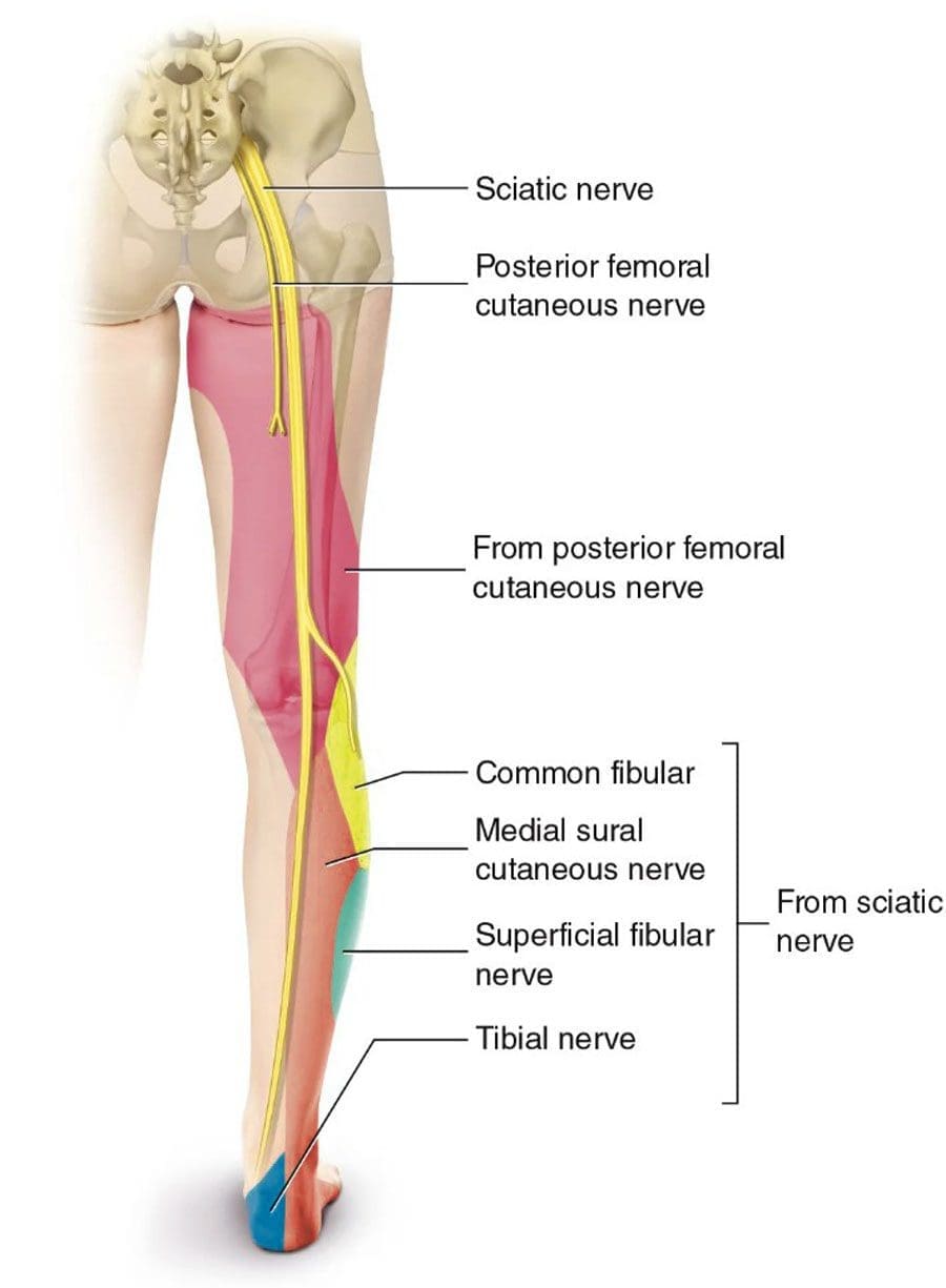 Natural Sciatica Healing Solutions for Pain Relief 