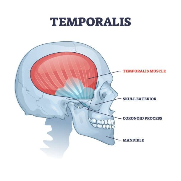 temporal-muscle.jpg
