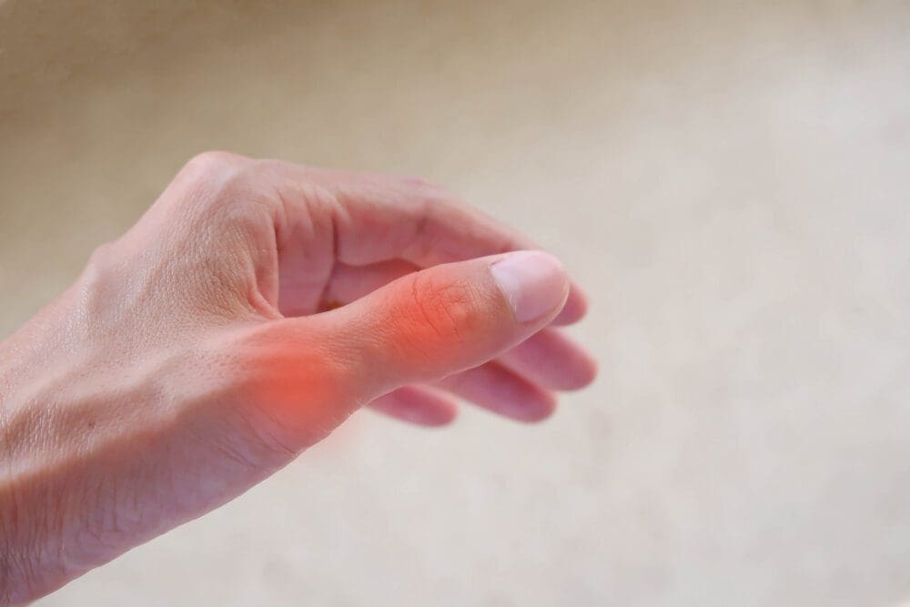 Myofascial triggersmerte, der påvirker tommelfingermusklerne