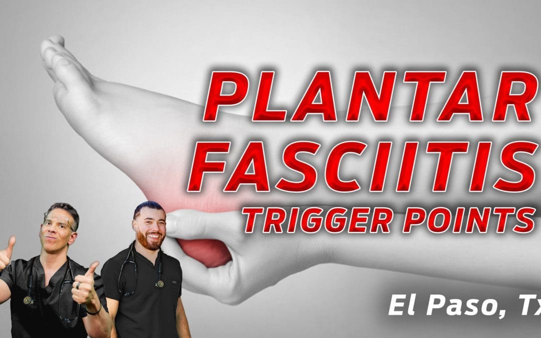 Plantar Fasciitis & Trigger Points On The Feet