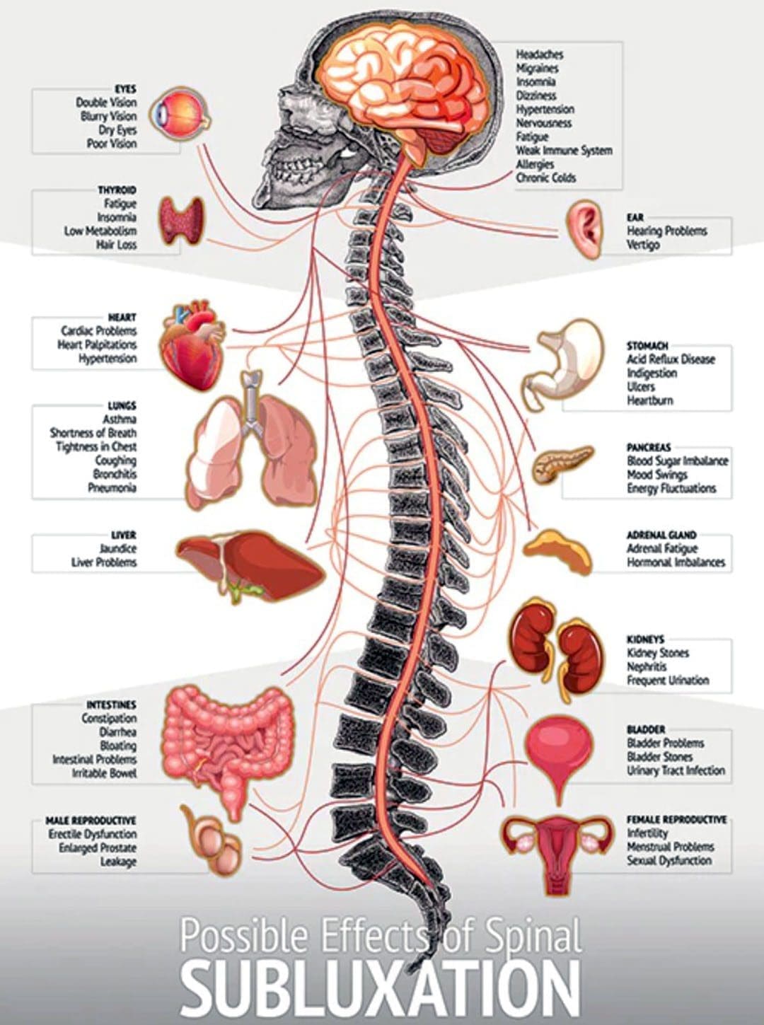 Bloating Constipation Chiropractic Solution for Relief