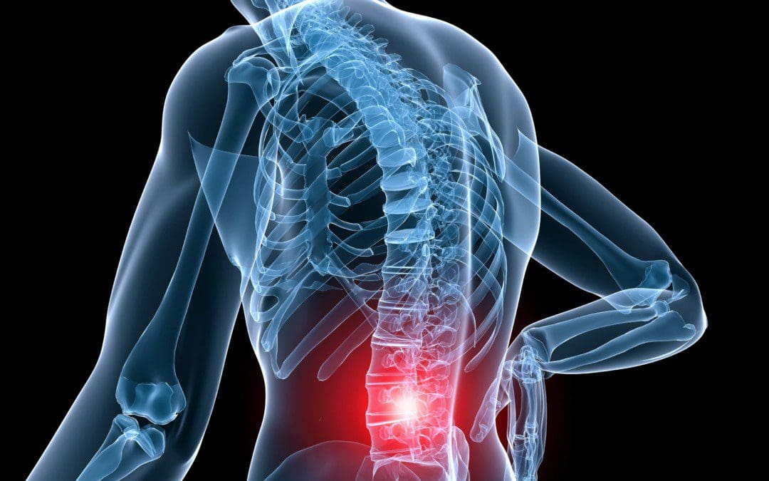 An Overview Of Vertebral Pain Syndrome