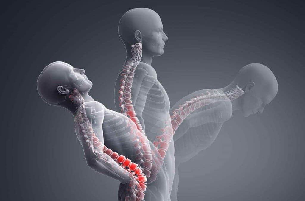 פרוטוקולי תסמונת פאסט לשחרור עמוד השדרה