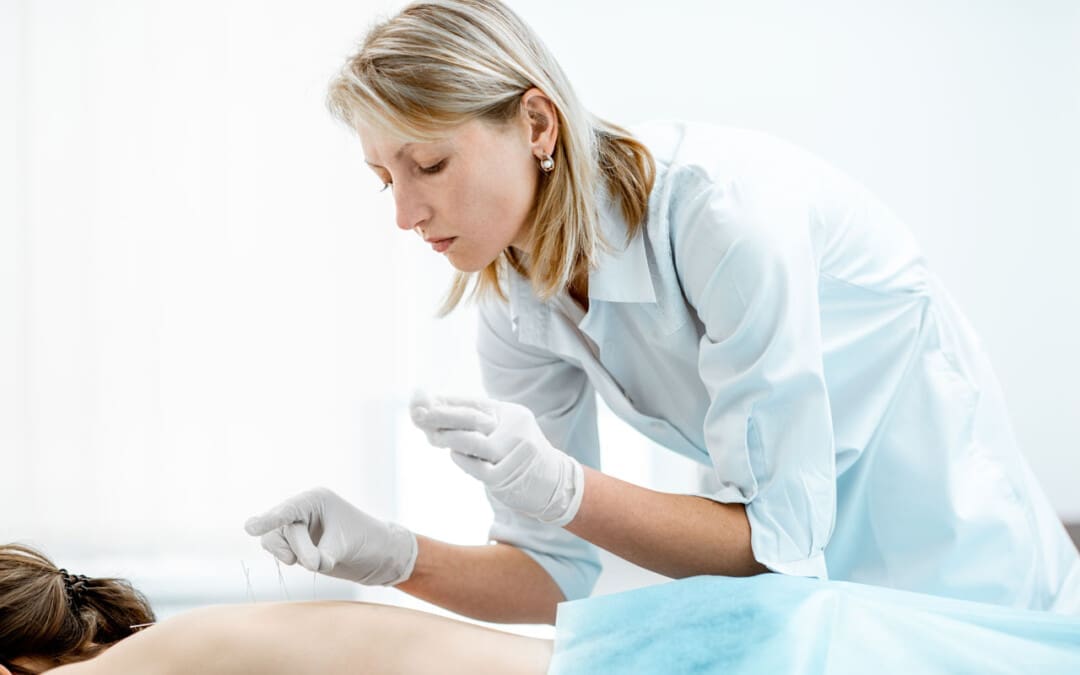 Acupunctuur gebruiken voor pijnbestrijding
