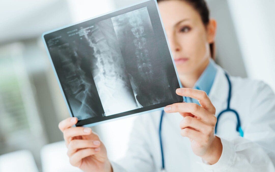 Comprender os efectos da terapia de descompresión espinal