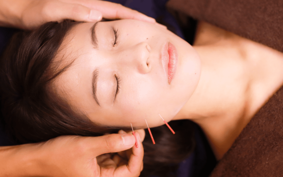 Treat Jaw Pain with Acupuncture: A Guide