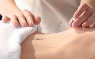 Acupuncture May Help Lower Gut Inflammation Pain