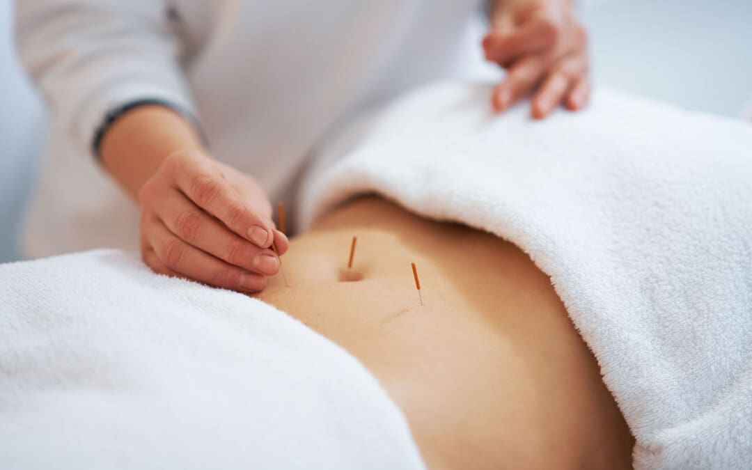 O papel da acupuntura na xestión dos síntomas da colite ulcerosa