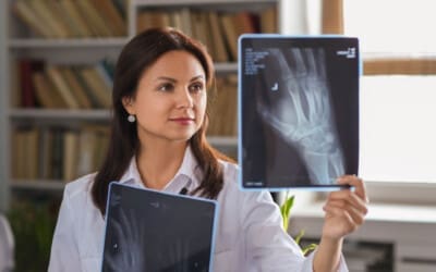 Scaphoid Fracture Recovery: What You Need to Know